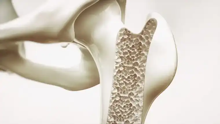 Getting Your Bone Density Test at Hollywood Diagnosticss