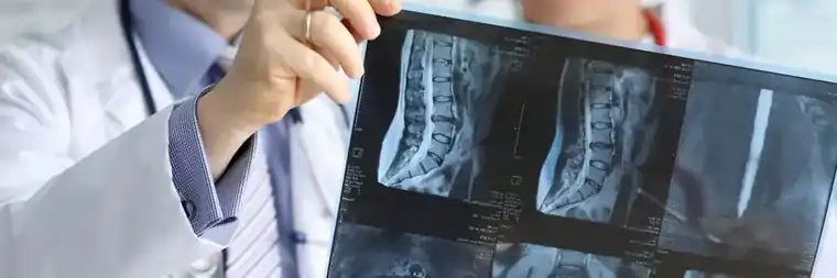 Important Facts About X-Rays