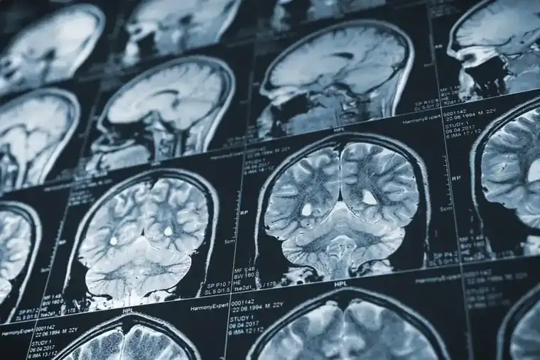 A Revolutionary Brain Scanning Helmet?