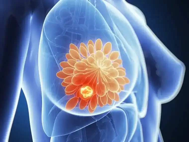 Learning How to Recognize Signs of Breast Cancer