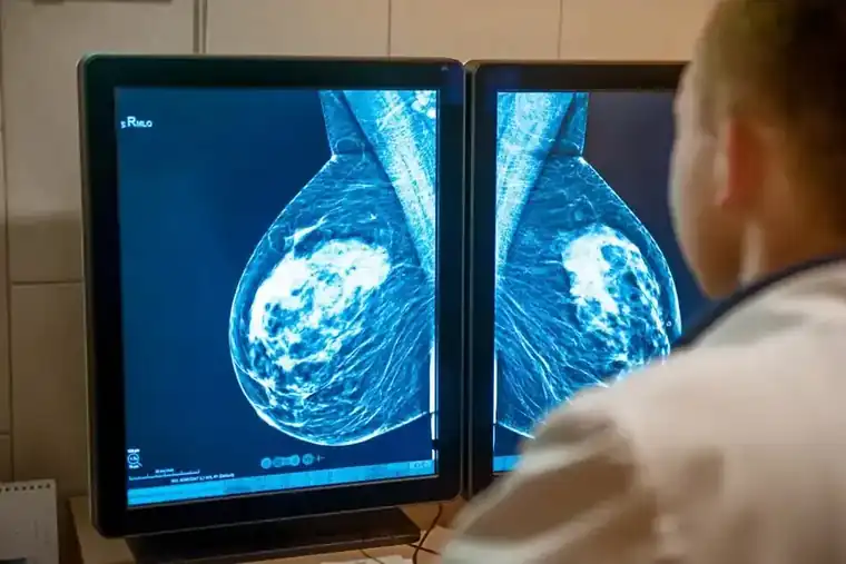 Why You Should Have Routine Mammograms