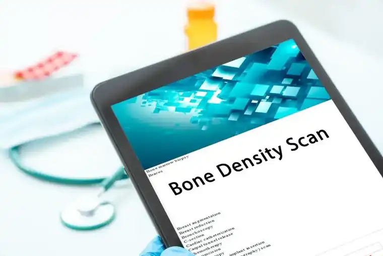 The Importance of Bone Density Scans When Aging: Spotlight on Hollywood Diagnostics