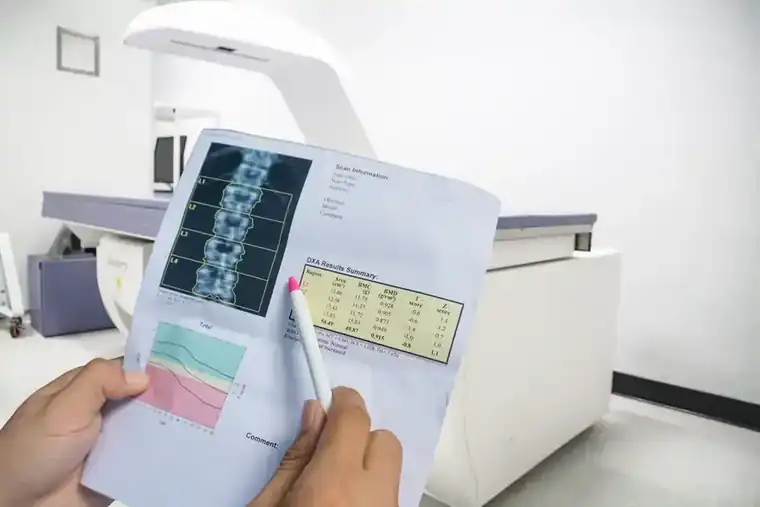bone density scan, Hollywood Diagnostics