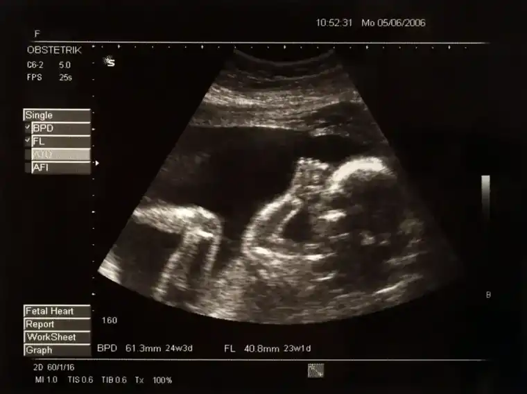 Choosing the Best Ultrasound Imaging Center for Your Pregnancy